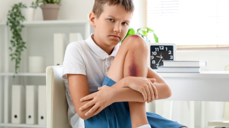 Dad says he found bruises all over his 7-year-old son — and by the time he learned what was happening at his ex-wife’s house, he says the custody fight had already turned into a race against the clock